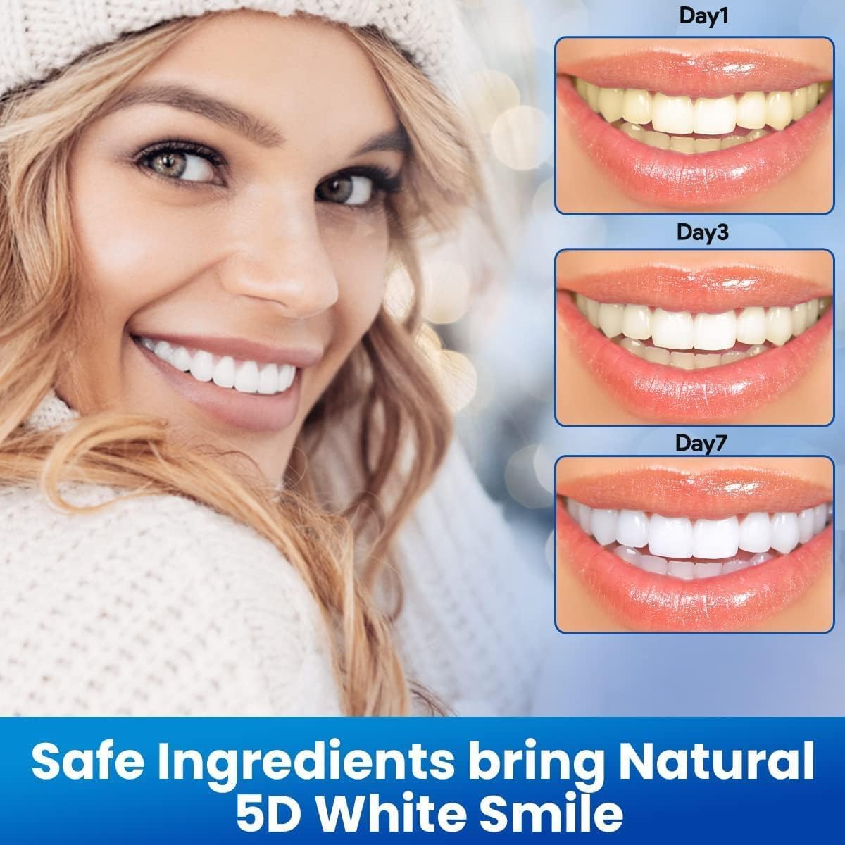 SmileGlow™ - Professional Teeth Whitening Strips